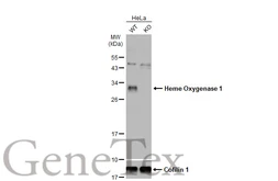 Anti-Heme Oxygenase 1 antibody used in Western Blot (WB). GTX101147