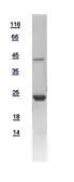 Human RAP2C protein, His tag. GTX108596-pro