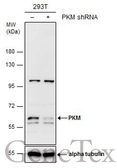Anti-PKM antibody used in Western Blot (WB). GTX111319
