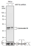 Anti-Cytokeratin 18 antibody [N1N3] used in Western Blot (WB). GTX112977