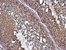 Anti-NMT1 antibody used in IHC (Paraffin sections) (IHC-P). GTX130852