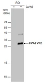 Anti-Coxsackievirus A6 VP2 antibody used in Western Blot (WB). GTX132348