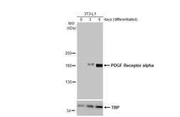 Anti-PDGF Receptor alpha antibody used in Western Blot (WB). GTX133588