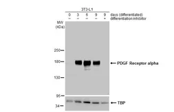 Anti-PDGF Receptor alpha antibody used in Western Blot (WB). GTX133620