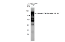 Human LOXL2 protein, His tag. GTX136930-pro