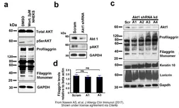 Anti-Filaggrin antibody [FLG01] used in Western Blot (WB). GTX23137