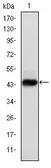 Anti-Human Papillomavirus type 16 E7 antibody [6F3] used in Western Blot (WB). GTX60410