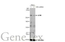 Anti-ATM antibody [2C1-RB] used in Western Blot (WB). GTX635395