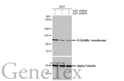Anti-O-GlcNAc transferase antibody [HL1641] used in Western Blot (WB). GTX637222