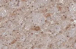 Anti-Collagen II antibody [HL1772] used in IHC (Paraffin sections) (IHC-P). GTX637424
