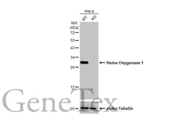Anti-Heme Oxygenase 1 antibody [HL1780] used in Western Blot (WB). GTX637432