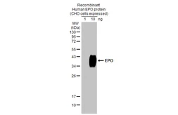 Anti-EPO antibody [HL1793] used in Western Blot (WB). GTX637445