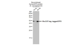 Anti-EPO antibody [HL1794] used in Western Blot (WB). GTX637446