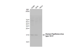Anti-Human Papillomavirus type 16 E7 antibody [HL1821] used in Western Blot (WB). GTX637546