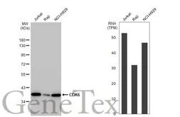 Anti-CDK6 antibody [HL2078] used in Western Blot (WB). GTX637986