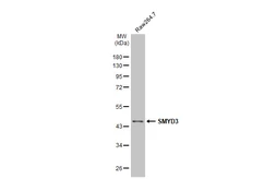 Anti-SMYD3 antibody [HL2464] used in Western Blot (WB). GTX638782