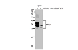 Anti-PRG2 antibody [HL2547] used in Western Blot (WB). GTX638919
