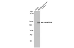 Anti-ADAMTSL2 antibody [HL2616] used in Western Blot (WB). GTX639070