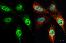 Anti-SETD1A antibody [HL2705] used in Immunocytochemistry/ Immunofluorescence (ICC/IF). GTX639459