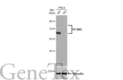 Anti-PCSK9 antibody [HL2815] used in Western Blot (WB). GTX639956