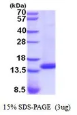 Human Cystatin D protein, His tag (active). GTX66965-pro