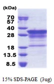 Human Myelin basic protein protein, His tag. GTX67547-pro