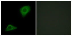 Anti-GPAT3 antibody used in Immunocytochemistry/ Immunofluorescence (ICC/IF). GTX87708